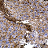 Immunohistochemistry - Anti-SLC14A1/UTE Antibody (A89857) - Antibodies.com