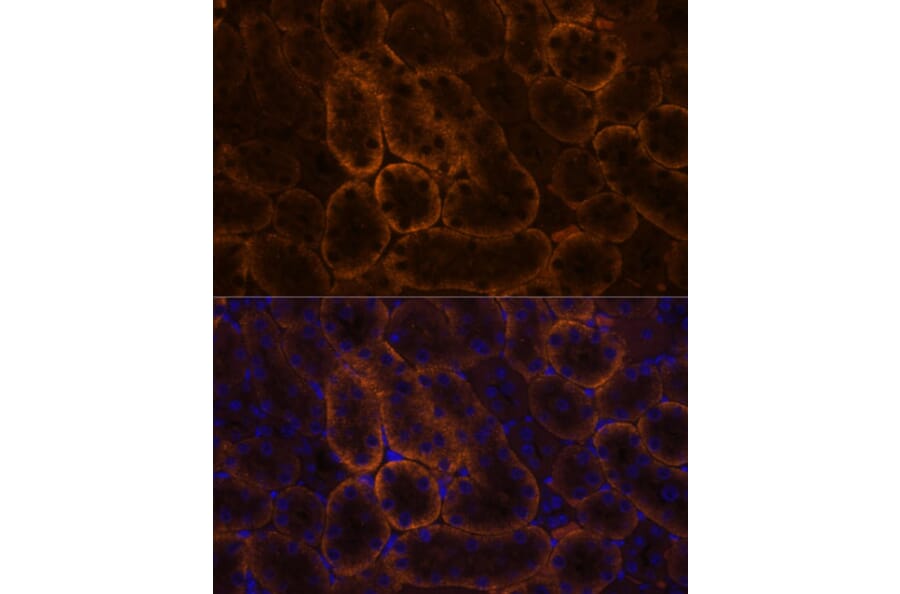 Immunofluorescence - Anti-SLC14A1/UTE Antibody (A89857) - Antibodies.com