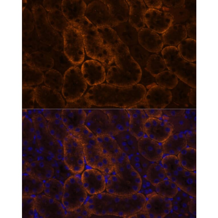 Immunofluorescence - Anti-SLC14A1/UTE Antibody (A89857) - Antibodies.com