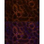 Immunofluorescence - Anti-SLC14A1/UTE Antibody (A89857) - Antibodies.com