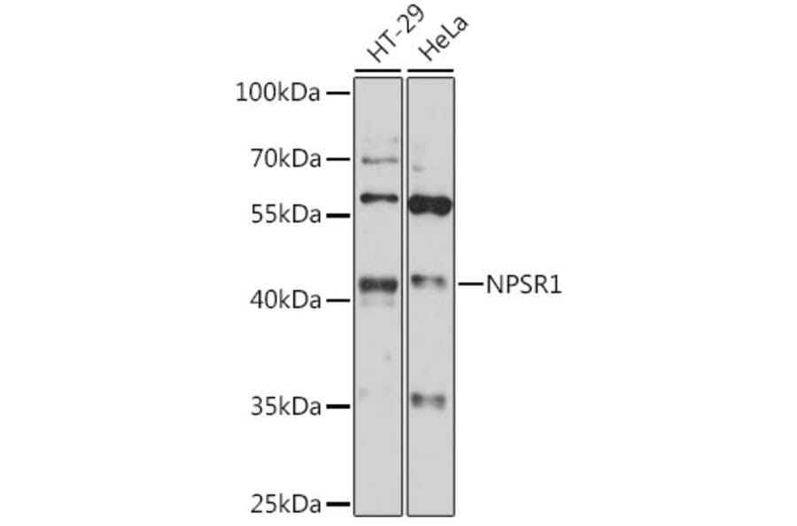 Western Blot - Anti-NPSR1 Antibody (A89858) - Antibodies.com