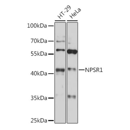 Western Blot - Anti-NPSR1 Antibody (A89858) - Antibodies.com