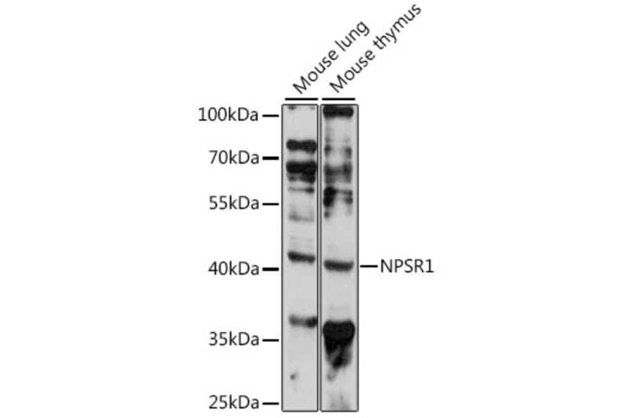 Western Blot - Anti-NPSR1 Antibody (A89859) - Antibodies.com