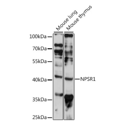 Western Blot - Anti-NPSR1 Antibody (A89859) - Antibodies.com