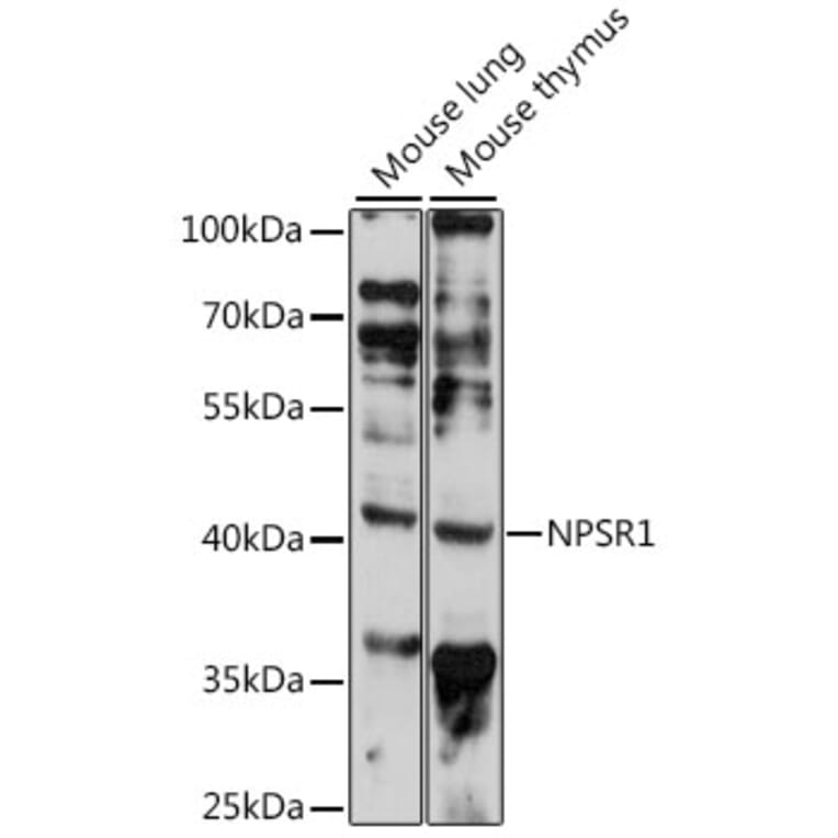 Western Blot - Anti-NPSR1 Antibody (A89859) - Antibodies.com