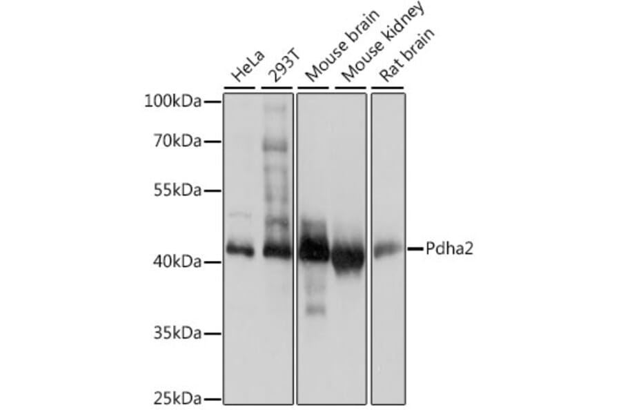 Western Blot - Anti-Pdha2 Antibody (A89860) - Antibodies.com