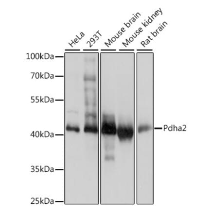 Western Blot - Anti-Pdha2 Antibody (A89860) - Antibodies.com