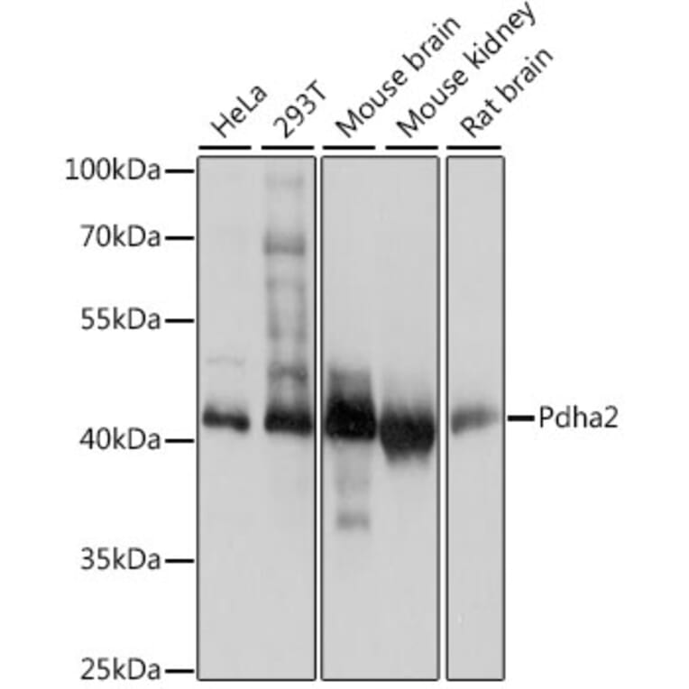 Western Blot - Anti-Pdha2 Antibody (A89860) - Antibodies.com