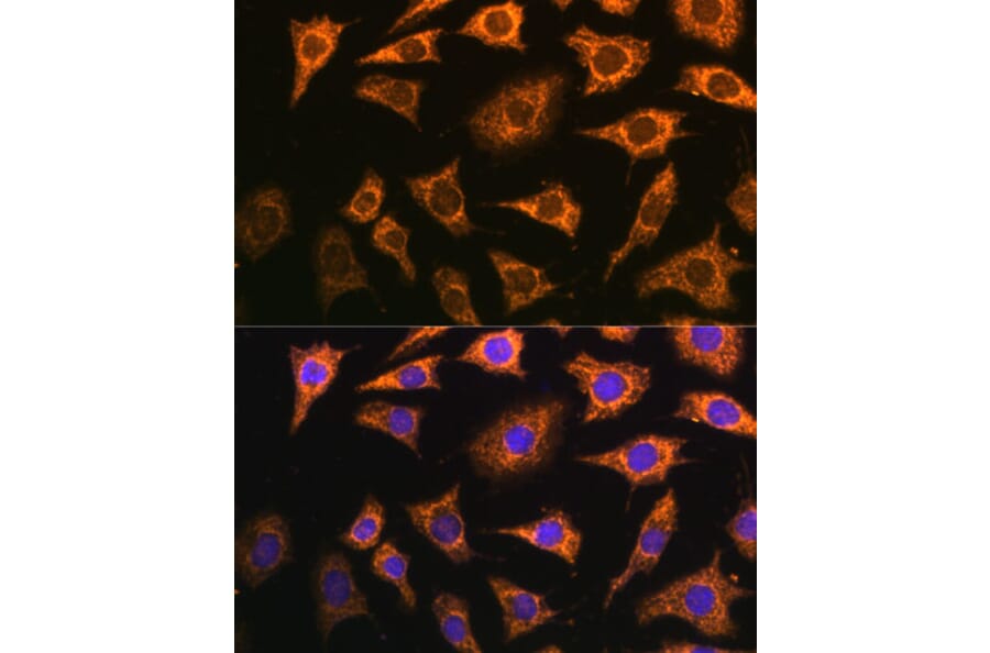 Immunofluorescence - Anti-Pdha2 Antibody (A89860) - Antibodies.com