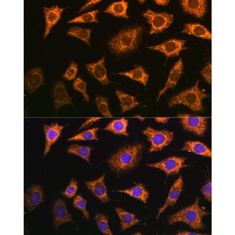 Immunofluorescence - Anti-Pdha2 Antibody (A89860) - Antibodies.com