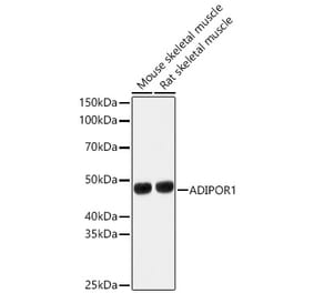 Western Blot - Anti-AdipoR1 Antibody (A89861) - Antibodies.com