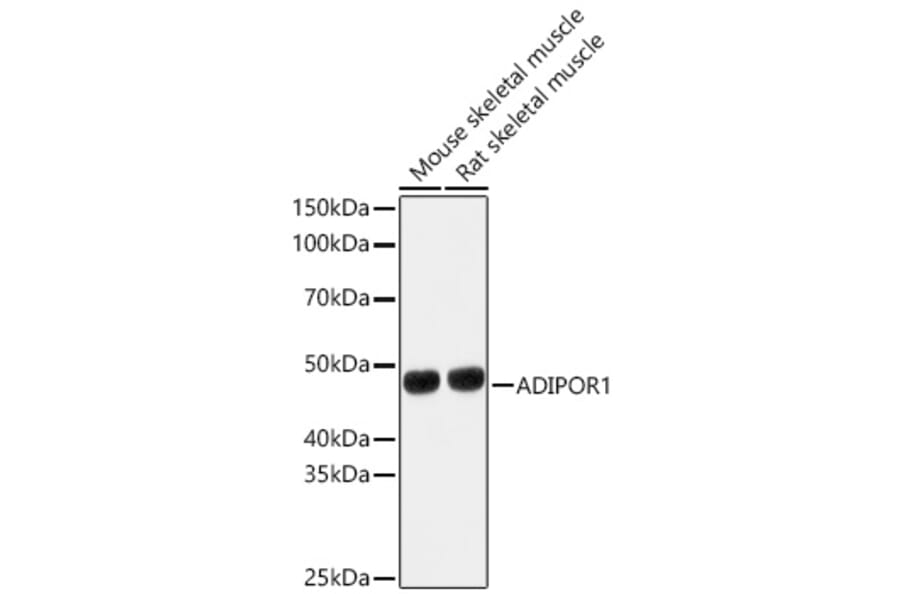 Western Blot - Anti-AdipoR1 Antibody (A89861) - Antibodies.com