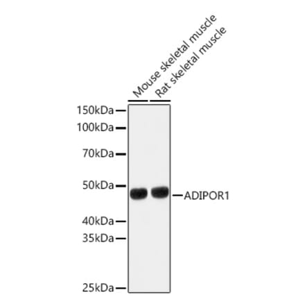 Western Blot - Anti-AdipoR1 Antibody (A89861) - Antibodies.com