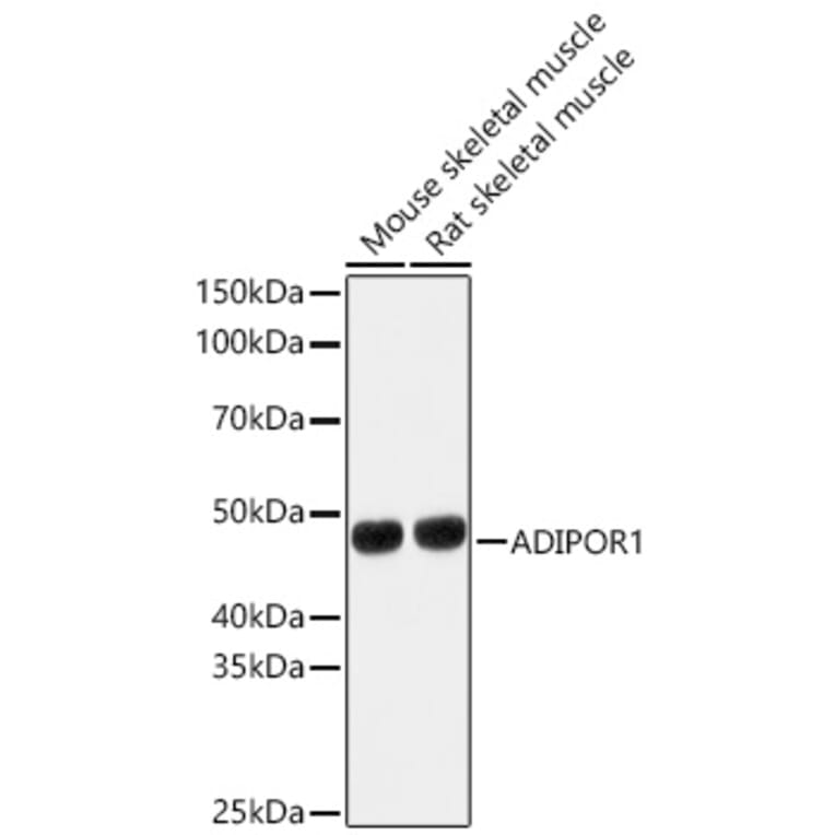 Western Blot - Anti-AdipoR1 Antibody (A89861) - Antibodies.com