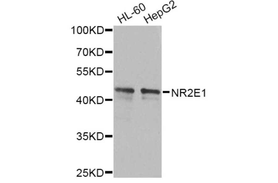 Western Blot - Anti-NR2E1 Antibody (A13361) - Antibodies.com