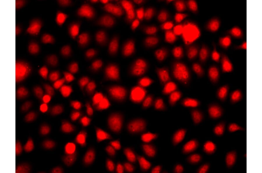 Immunofluorescence - Anti-NR2E1 Antibody (A13361) - Antibodies.com