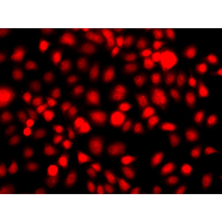 Immunofluorescence - Anti-NR2E1 Antibody (A13361) - Antibodies.com