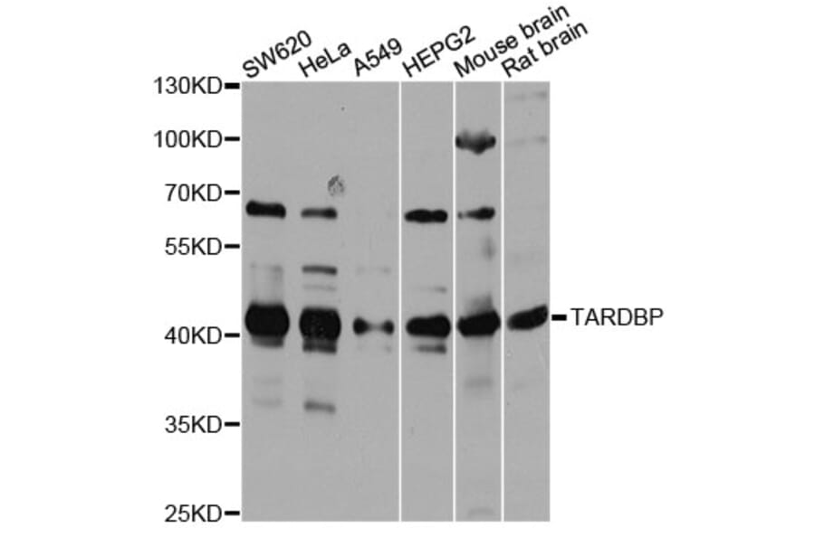Western Blot - Anti-TARDBP Antibody (A13404) - Antibodies.com