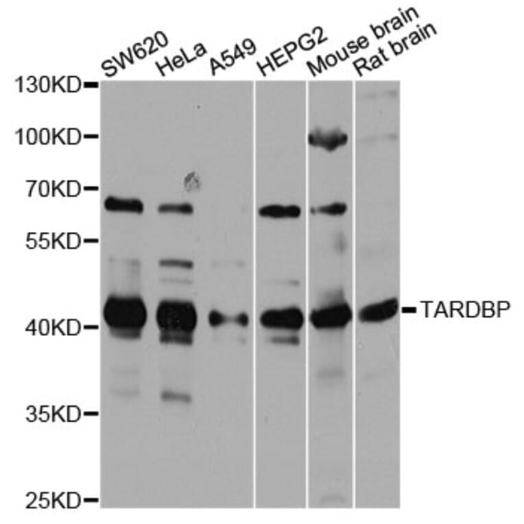Western Blot - Anti-TARDBP Antibody (A13404) - Antibodies.com