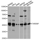 Western Blot - Anti-TARDBP Antibody (A13404) - Antibodies.com