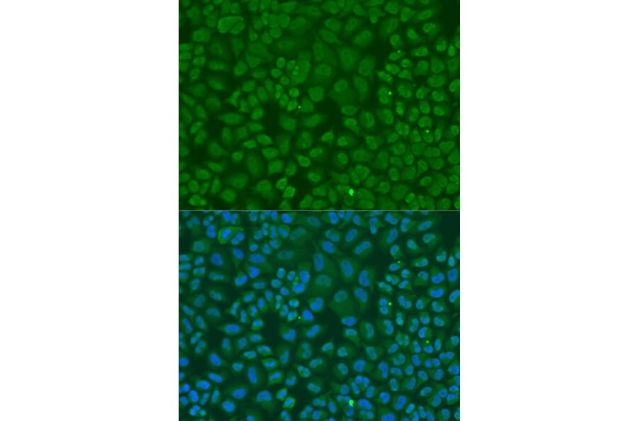 Immunofluorescence - Anti-TARDBP Antibody (A13404) - Antibodies.com