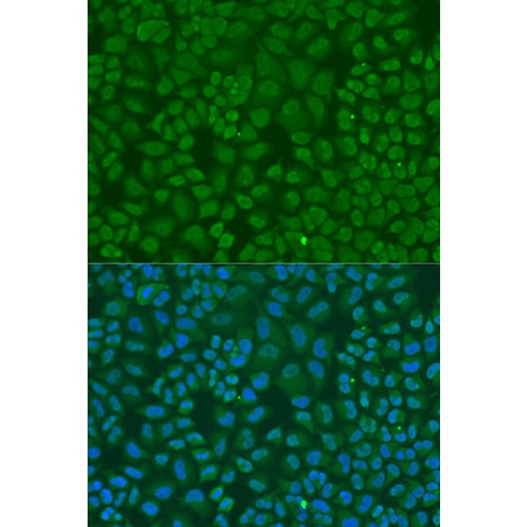 Immunofluorescence - Anti-TARDBP Antibody (A13404) - Antibodies.com