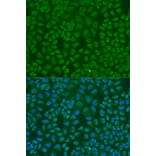 Immunofluorescence - Anti-TARDBP Antibody (A13404) - Antibodies.com