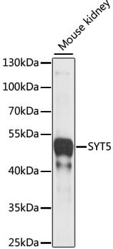 Western blot analysis of extracts of Mouse kidney, using Anti-SYT5 Antibody (A15321) at 1:1,000 dilution.
Secondary antibody: Goat Anti-Rabbit IgG (H+L) (HRP) (AS014) at 1:10,000 dilution.
Lysates / proteins: 25µg per lane.
Blocking buffer: 3% non-fat dry milk in TBST.
Detection: ECL Basic Kit (RM00020).
Exposure time: 5s.