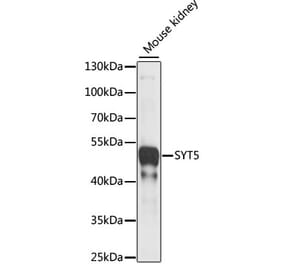 Western Blot - Anti-Synaptotagmin Antibody (A89864) - Antibodies.com