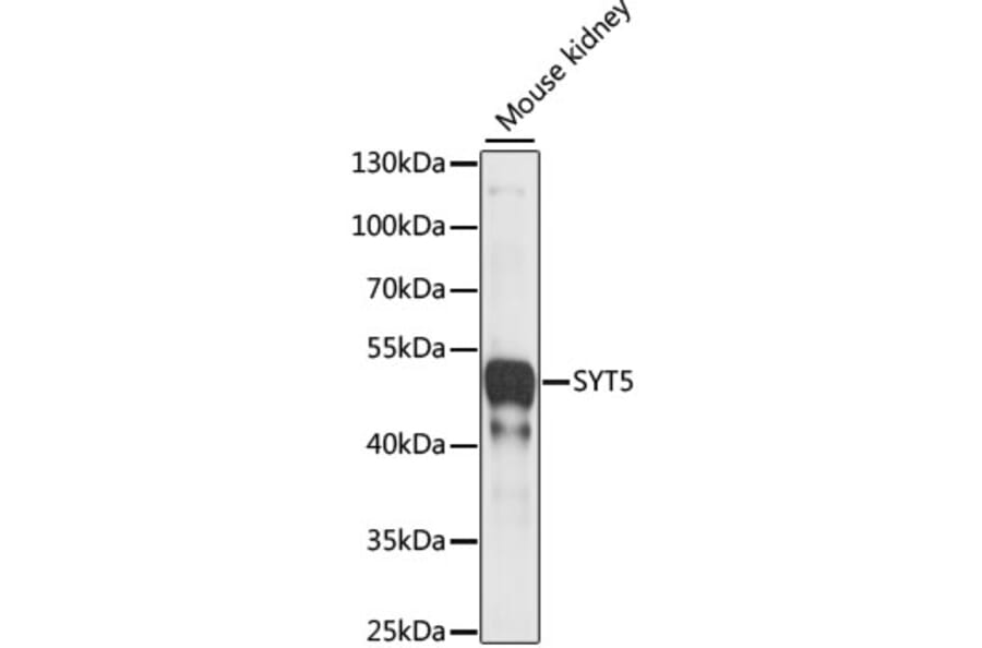 Western Blot - Anti-Synaptotagmin Antibody (A89864) - Antibodies.com