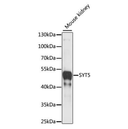 Western Blot - Anti-Synaptotagmin Antibody (A89864) - Antibodies.com
