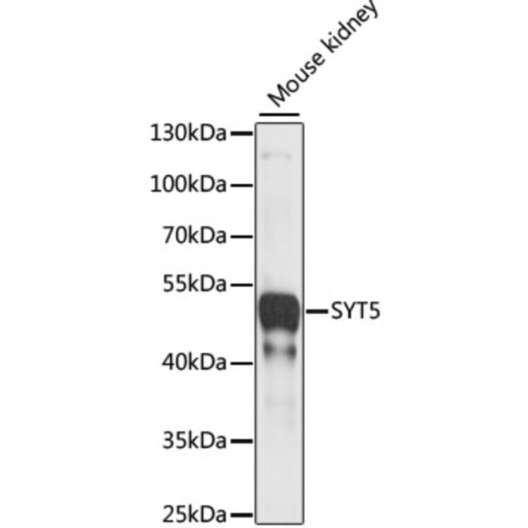 Western Blot - Anti-Synaptotagmin Antibody (A89864) - Antibodies.com