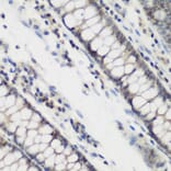 Immunohistochemistry - Anti-DHODH Antibody (A89865) - Antibodies.com