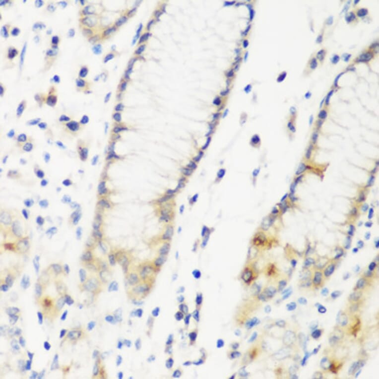 Immunohistochemistry - Anti-DHODH Antibody (A89865) - Antibodies.com