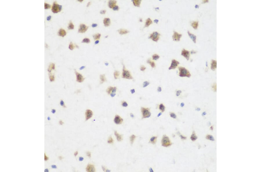 Immunohistochemistry - Anti-DHODH Antibody (A89865) - Antibodies.com