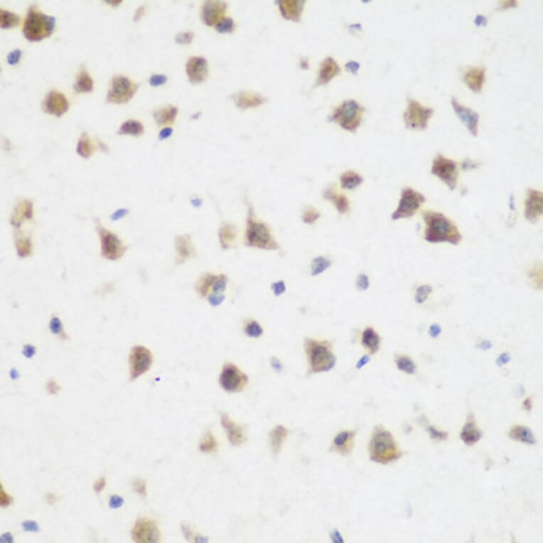 Immunohistochemistry - Anti-DHODH Antibody (A89865) - Antibodies.com