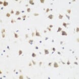 Immunohistochemistry - Anti-DHODH Antibody (A89865) - Antibodies.com