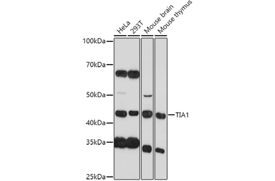 Western Blot - Anti-TIA1 Antibody (A89866) - Antibodies.com