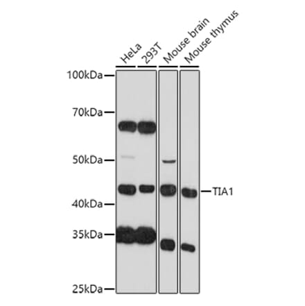 Western Blot - Anti-TIA1 Antibody (A89866) - Antibodies.com