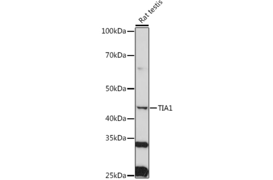 Western Blot - Anti-TIA1 Antibody (A89866) - Antibodies.com