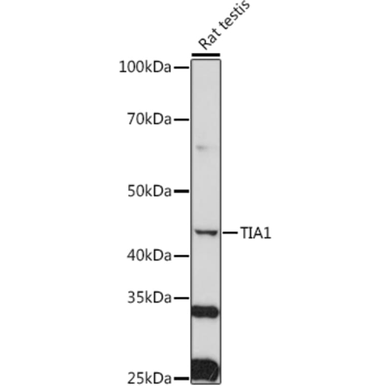 Western Blot - Anti-TIA1 Antibody (A89866) - Antibodies.com