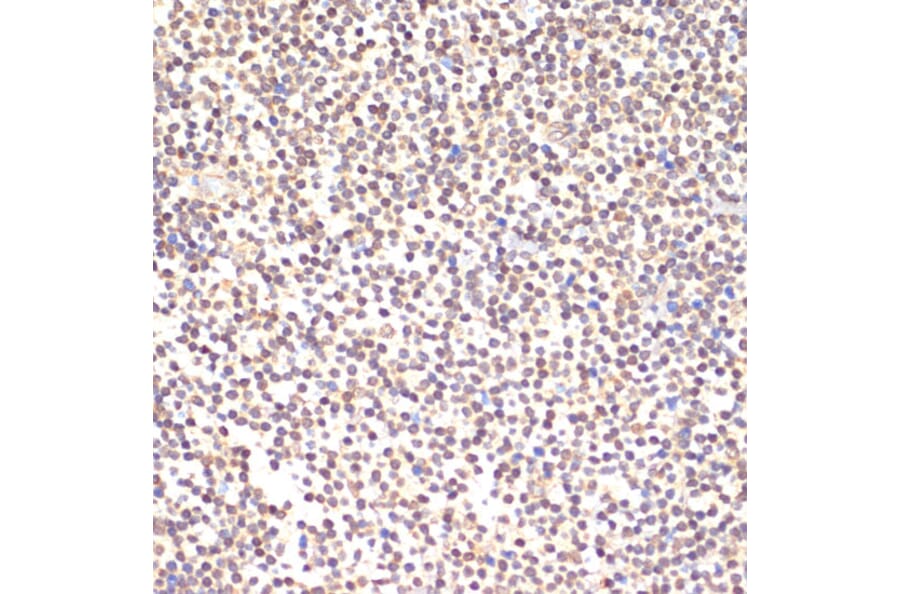 Immunohistochemistry - Anti-TIA1 Antibody (A89866) - Antibodies.com