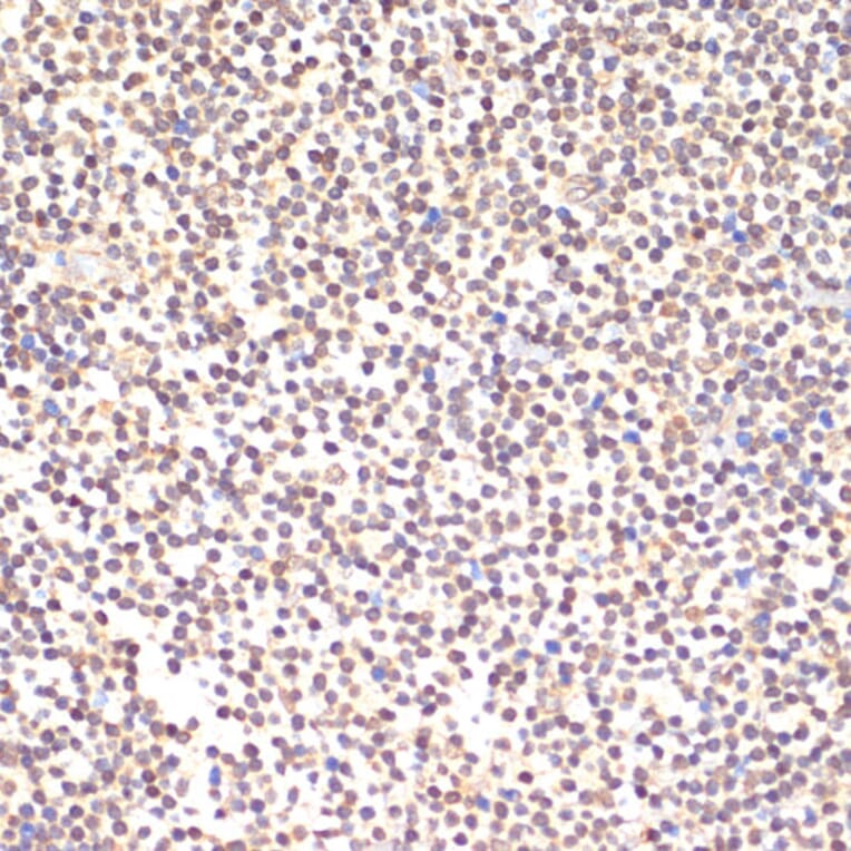 Immunohistochemistry - Anti-TIA1 Antibody (A89866) - Antibodies.com