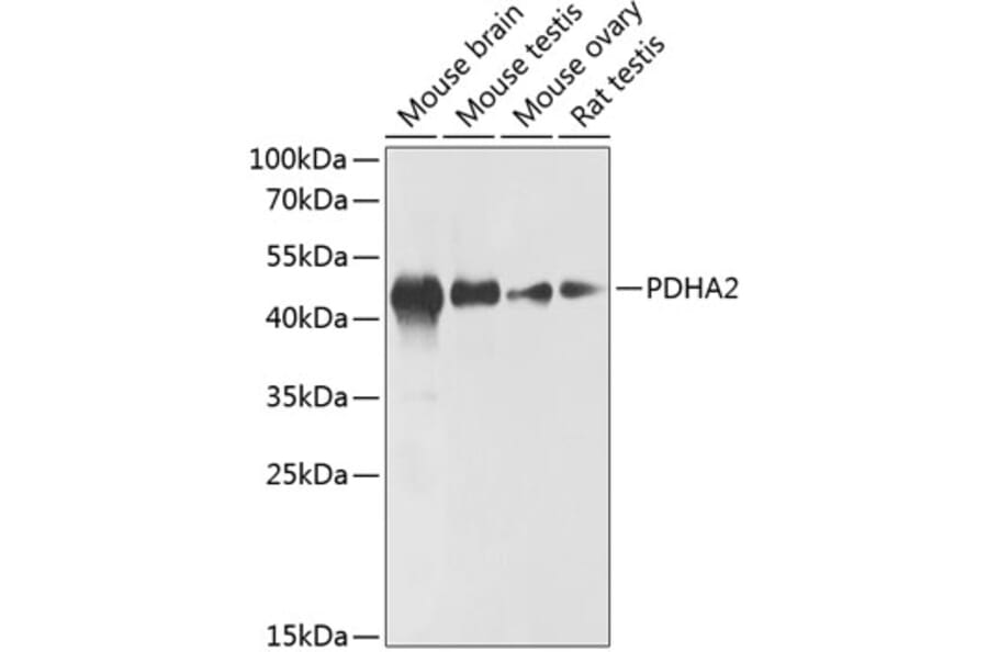 Western Blot - Anti-PDHA2 Antibody (A89867) - Antibodies.com