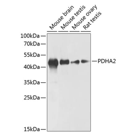 Western Blot - Anti-PDHA2 Antibody (A89867) - Antibodies.com