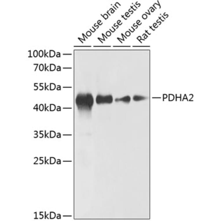 Western Blot - Anti-PDHA2 Antibody (A89867) - Antibodies.com