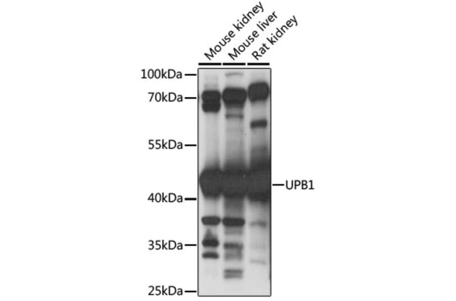 Western Blot - Anti-UPB1 Antibody (A89868) - Antibodies.com