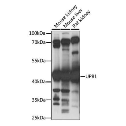 Western Blot - Anti-UPB1 Antibody (A89868) - Antibodies.com