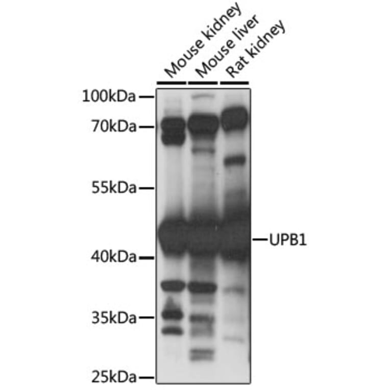 Western Blot - Anti-UPB1 Antibody (A89868) - Antibodies.com