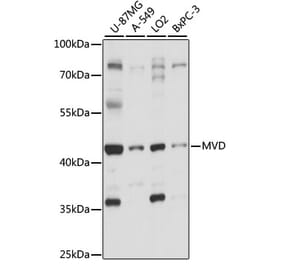 Western Blot - Anti-MVD Antibody (A89869) - Antibodies.com